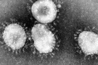 Eine Mikroskopaufnahme zeigt das Coronavirus (Archivbild): In Stuttgart ist die südafrikanische Variante des Coronavirus festgestellt worden.