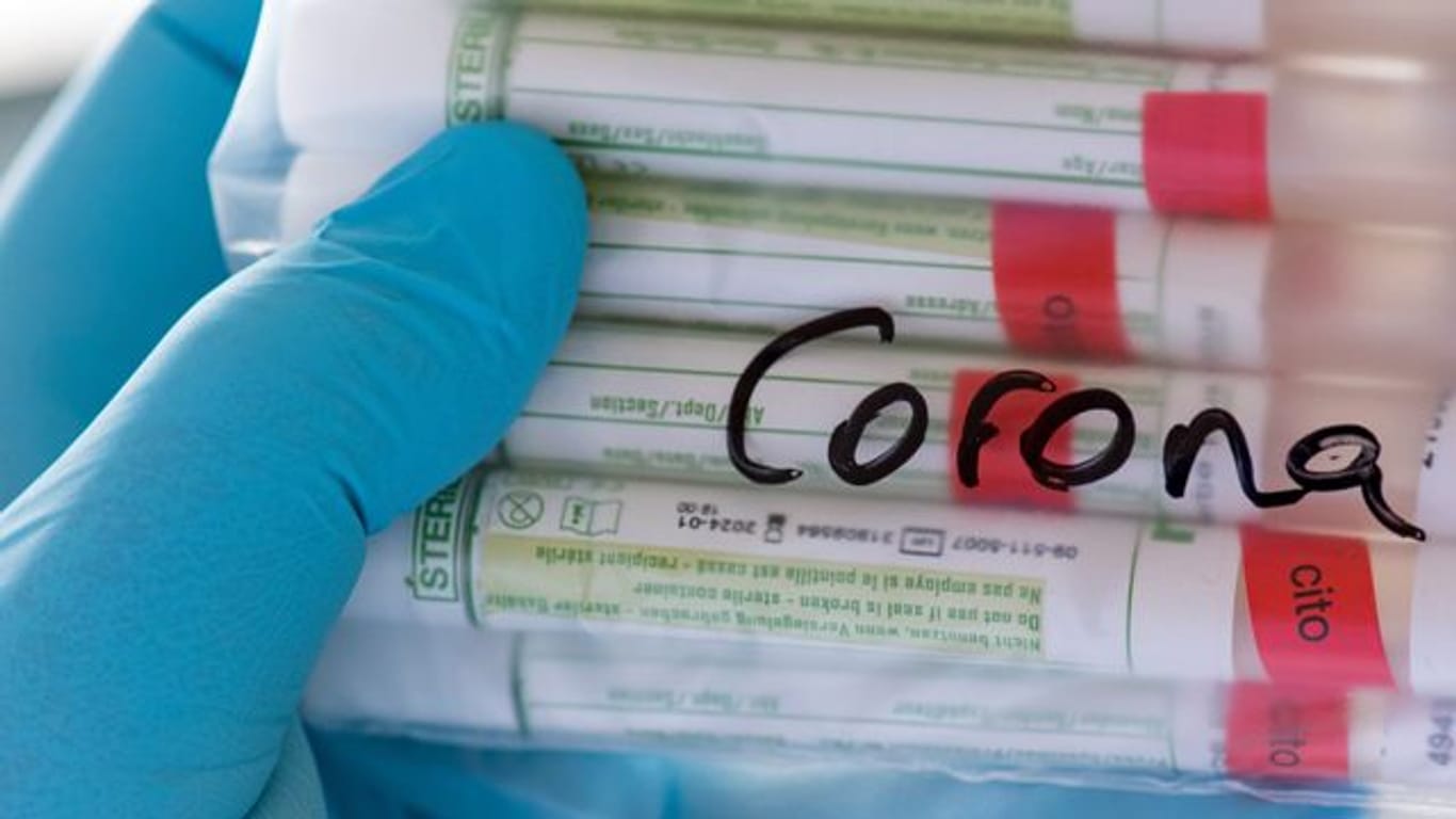 Symbolbild "Coronavirus - Test"