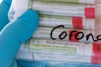 Symbolbild "Coronavirus - Test"
