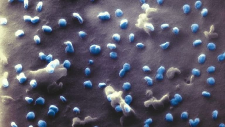Coronaviren (blau) beim Austritt aus einer Nierenzelle, aufgenommen mit einem Heliumionen-Mikroskop.