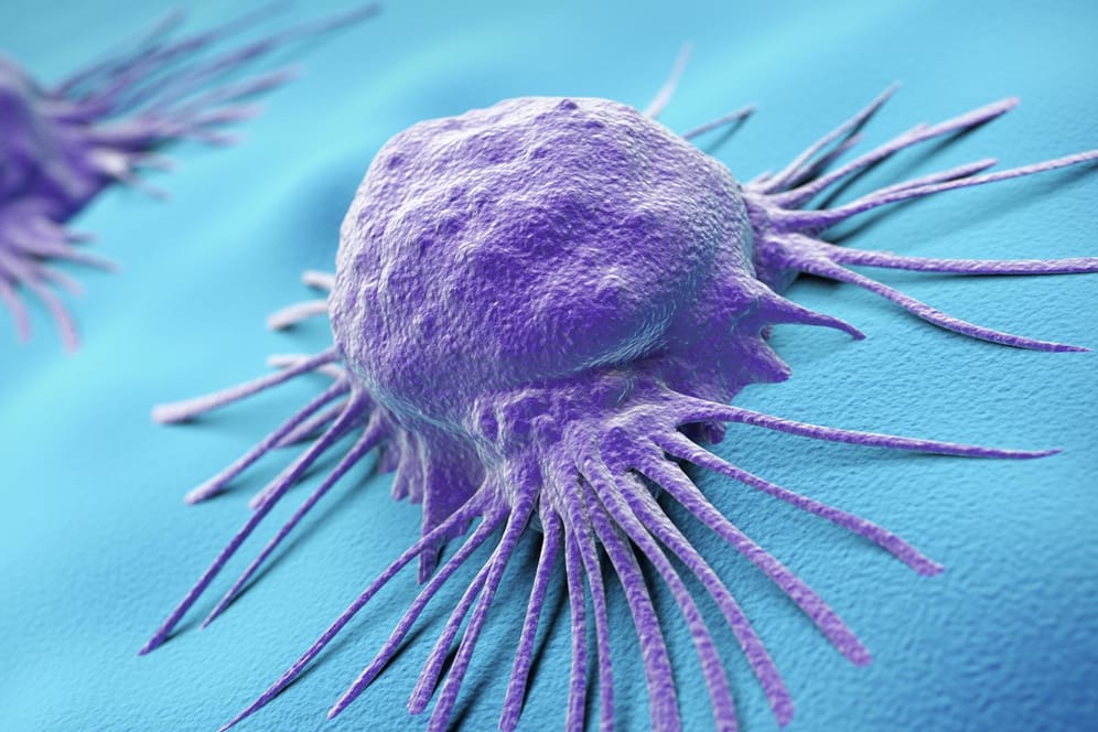 Krebszellen: Sie dringen immer tiefer in angrenzendes Gewebe vor, wo sie sich vermehren und das gesunde Gewebe mehr und mehr zerstören. (Symbolbild)