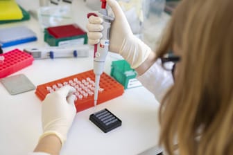 Coronavirus-Test im Labor: Mehr als 10.000 Neuinfektionen haben die Gesundheitsämter an das RKI gemeldet.