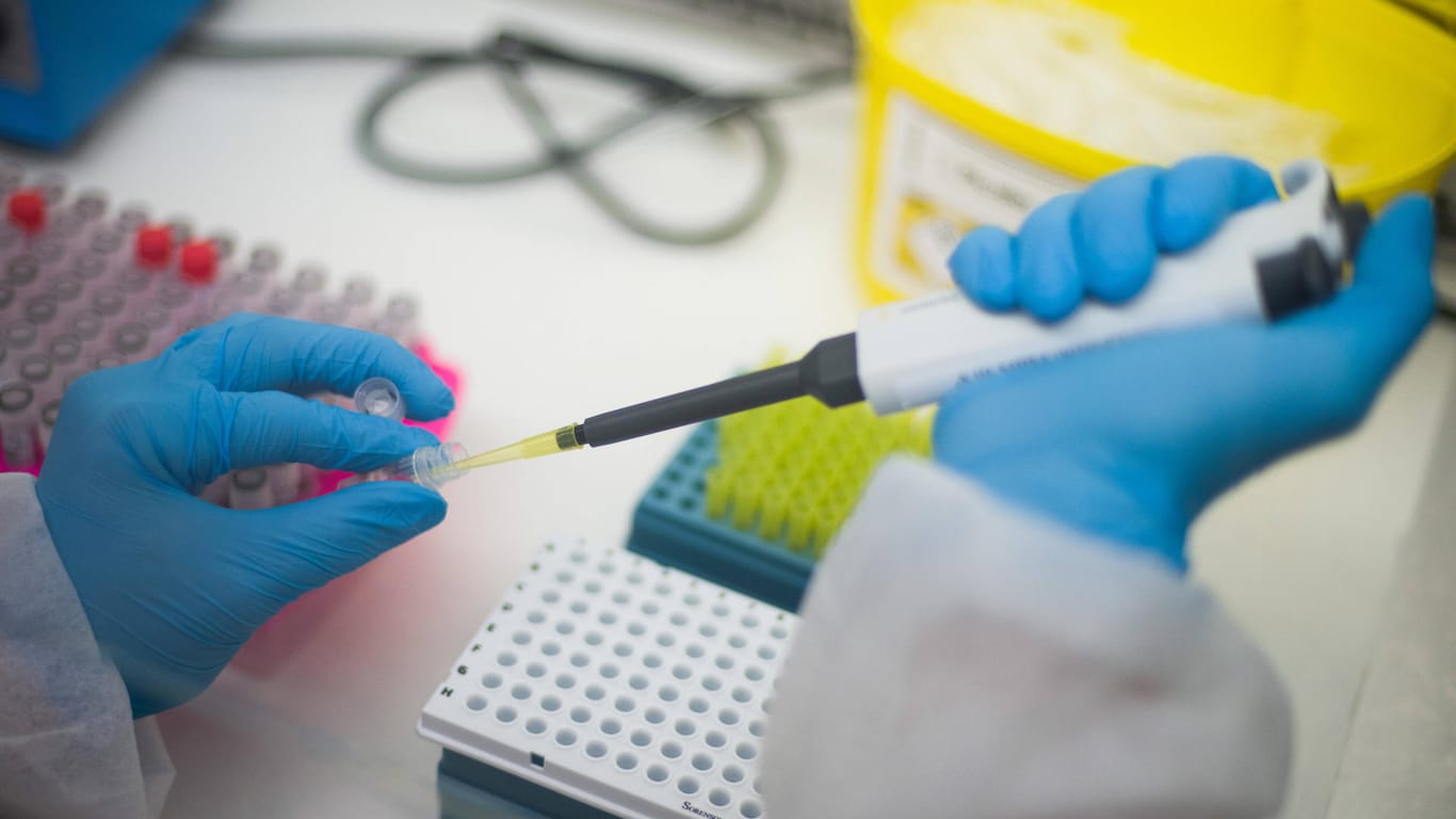 Proben werden in einem Labor untersucht (Symbolbild): Seit dem 1. Februar untersucht die Stadt Düsseldorf alle positiven PCR-Tests auf Corona-Mutationen.
