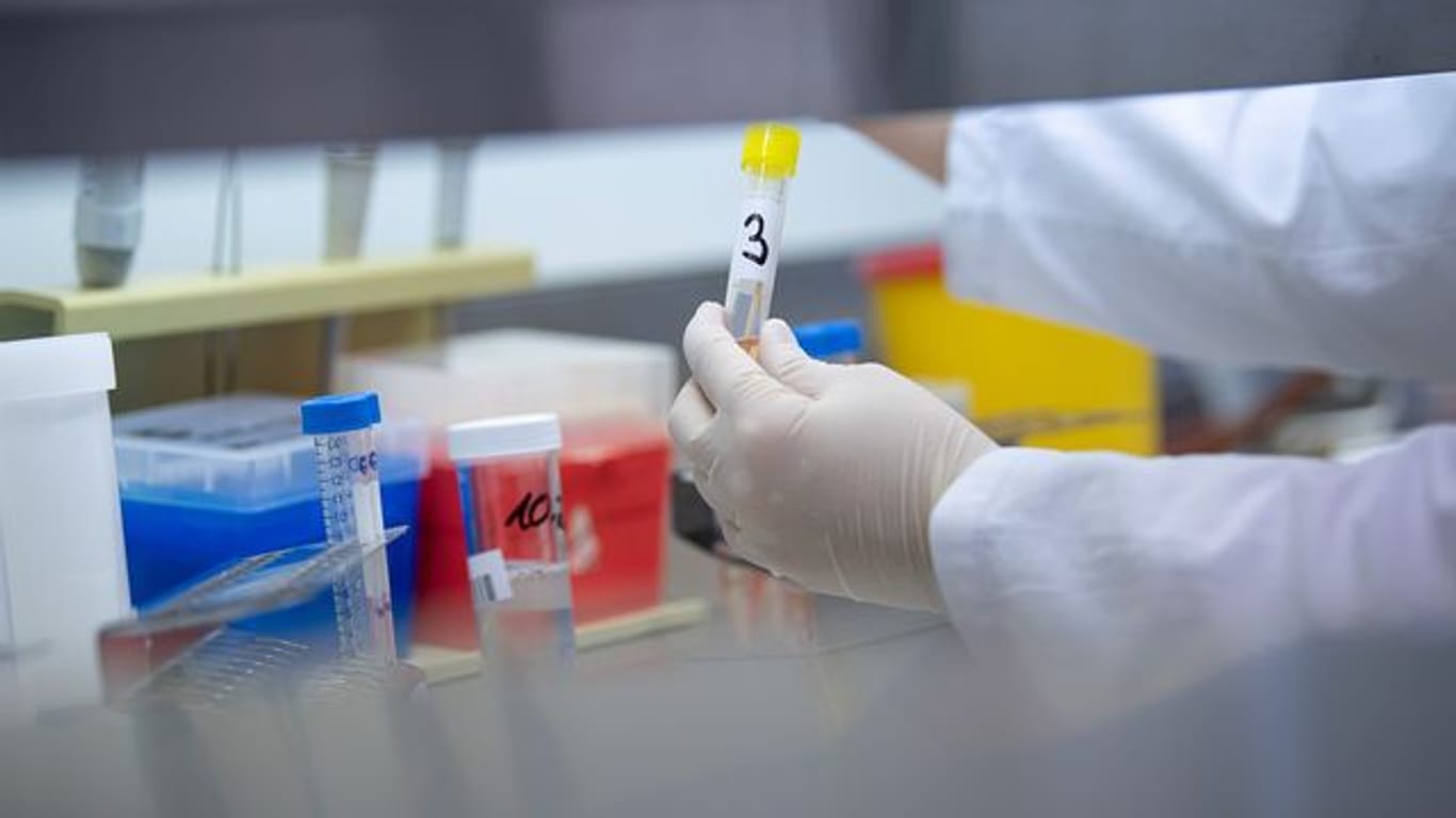 Eine Ärztin zeigt in einem Labor einen Test für das Coronavirus (Symbolbild): In Hagen ist der Inzidenzwert im Vergleich zu ganz NRW weiterhin hoch.