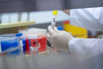 Eine Ärztin zeigt in einem Labor einen Test für das Coronavirus (Symbolbild): In Hagen ist der Inzidenzwert im Vergleich zu ganz NRW weiterhin hoch.