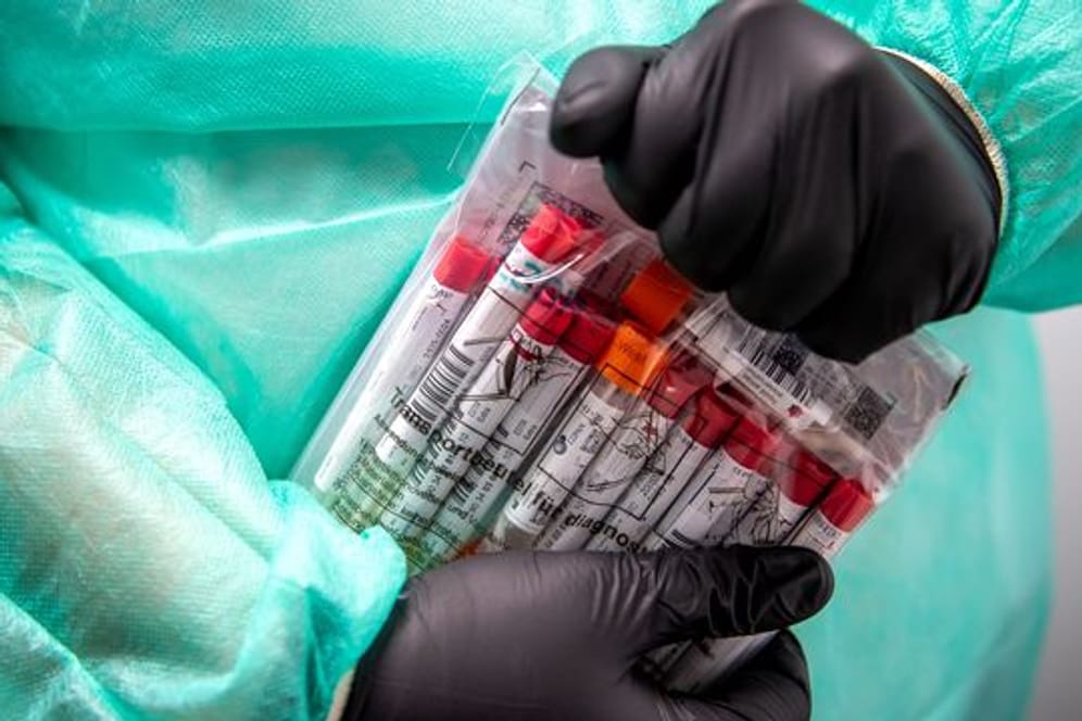 Proben für einen PCR-Test werden von einem Laboranten verpackt