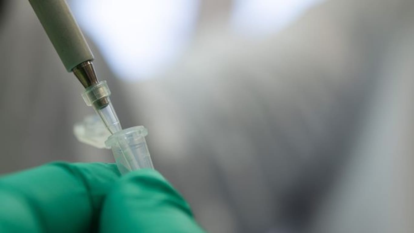 Ein Forscher zeigt, wie ein PCR-Test für die Analyse und Untersuchung auf Mutationen des Coronavirus vorbereitet wird.