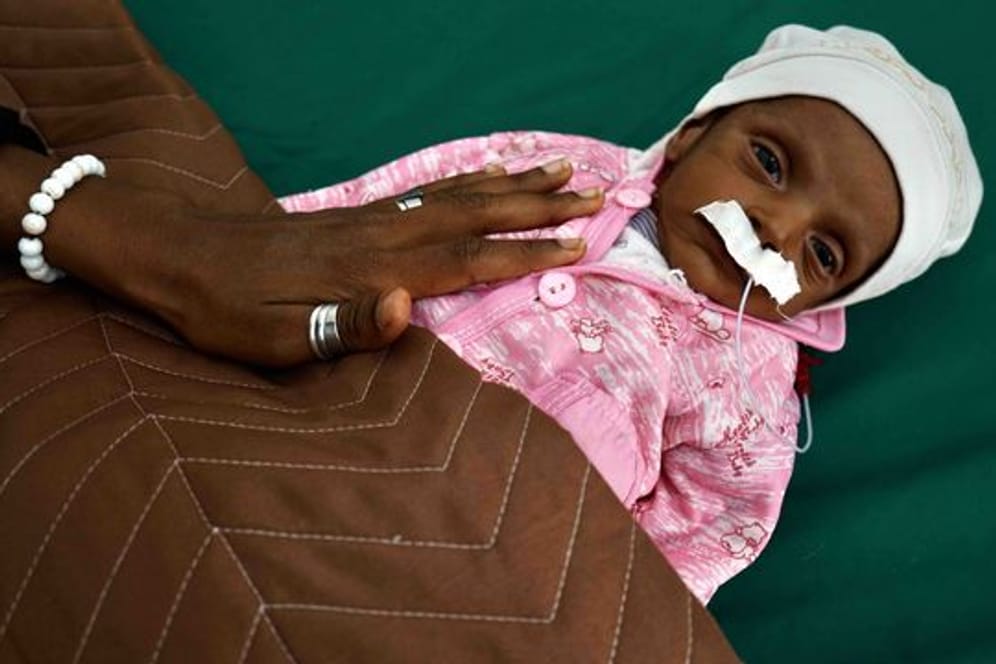 Ein wenige Wochen altes Baby, das an Unterernährung leidet, liegt in einem Krankenhaus in Aden.