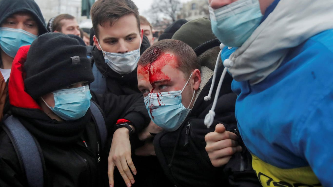 Ein verletzter Demonstrant auf einer Pro-Nawalny-Kundgebung in Moskau wird von seinen Freunden unterstützt: Die russische Regierung geht gegen Internetplattformen vor, auf denen zu Protesten aufgerufen wird.