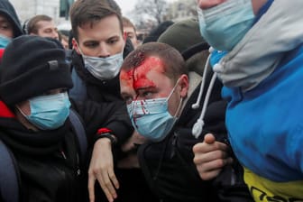 Ein verletzter Demonstrant auf einer Pro-Nawalny-Kundgebung in Moskau wird von seinen Freunden unterstützt: Die russische Regierung geht gegen Internetplattformen vor, auf denen zu Protesten aufgerufen wird.