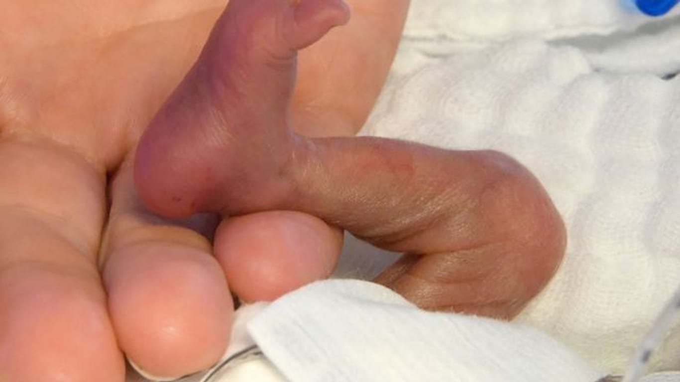 Strenge Corona-Regeln in Geburtenstationen können fatale Folgen für Frühgeborene haben.