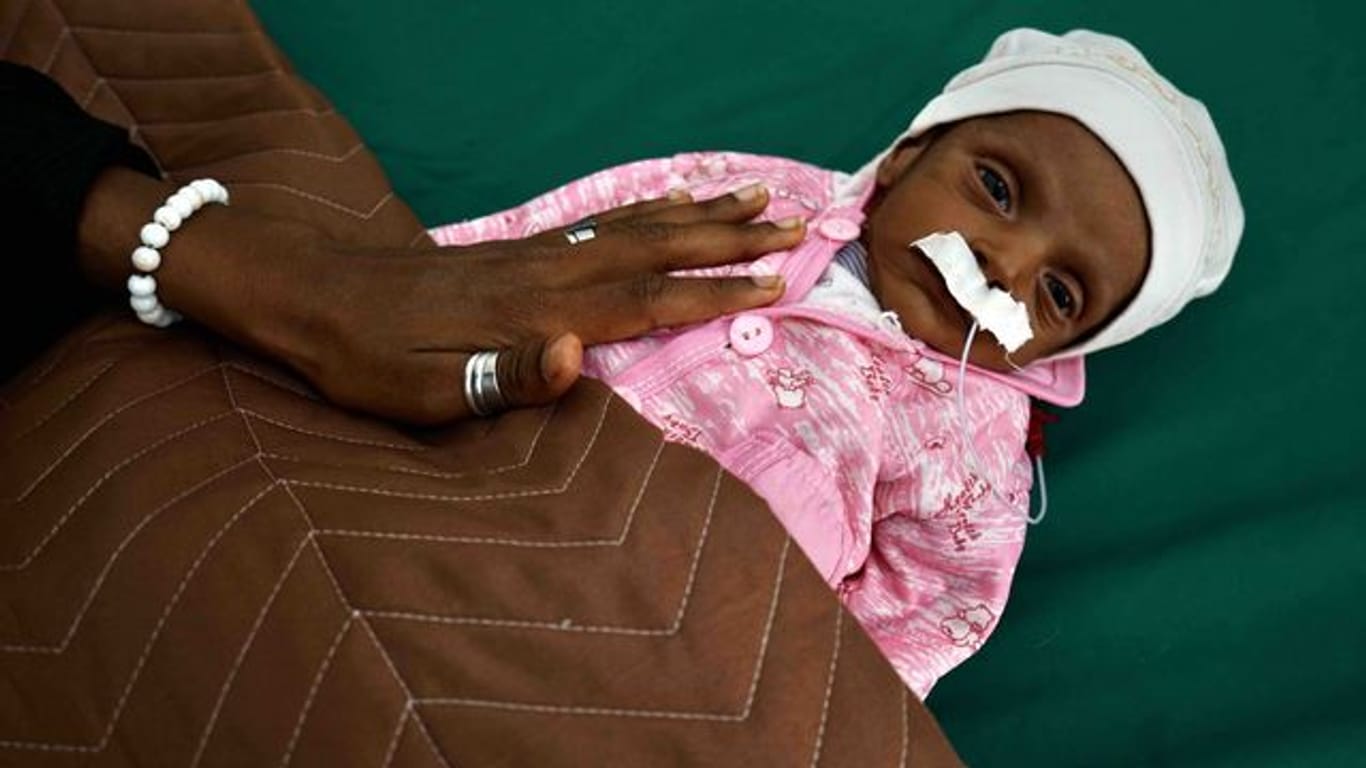 Ein 38 Tage altes unterernährtes Baby in einem Krankenhaus im Jemen.