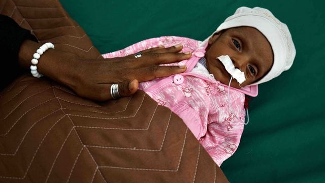 Ein 38 Tage altes unterernährtes Baby in einem Krankenhaus im Jemen. Ein 38 Tage altes unterernährtes Baby in einem Krankenhaus im Jemen.