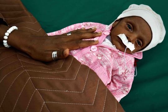 Ein 38 Tage altes unterernährtes Baby in einem Krankenhaus im Jemen.