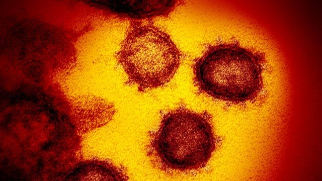 Die Elektronenmikroskopaufnahme zeigt das Coronavirus SARS-CoV-2.