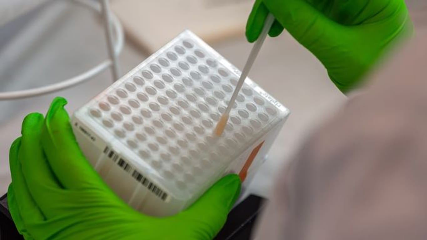 Eine Labormitarbeiterin arbeitet an der Einsortierung der Stäbchen mit Zellen der Wangenschleimhaut für den Typisierungsprozess der DNA (Archivbild): In Nürnberg kann man sich nun beim Corona-Test für eine Stammzellspende registrieren.