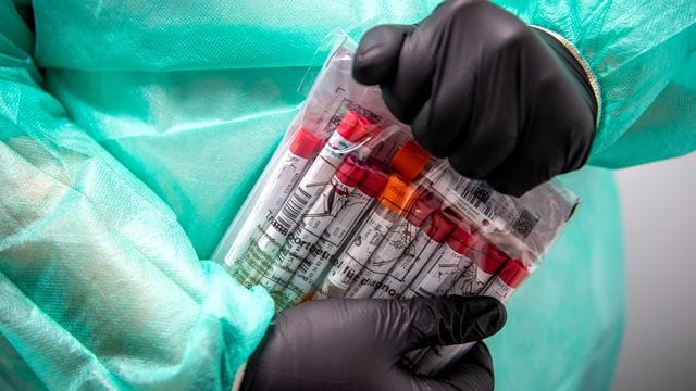 Proben für einen PCR-Test werden von einem Laboranten verpackt Proben für einen PCR-Test werden von einem Laboranten verpackt