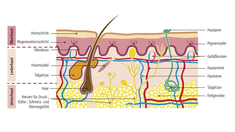 Aufbau der Haut: Eine Epidermalzyste entwickelt sich aus den Zellen der Hornschicht in der Oberhaut.