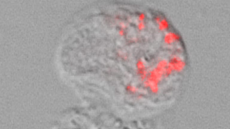 Lichtmikroskopische Aufnahme einer Amöbe mit "Ca. Pokemonas kadabra": Die Bakterien wurden mittels sogenannter "Fluoreszenz-in-situ-Hybridisierung" rot angefärbt.