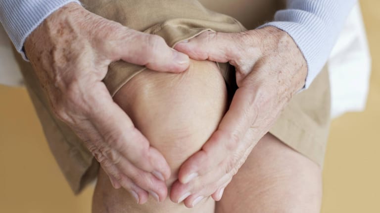 Knie einer Seniorin: Ermüdungsbrüche können bei Überbelastung der Knochen auftreten.