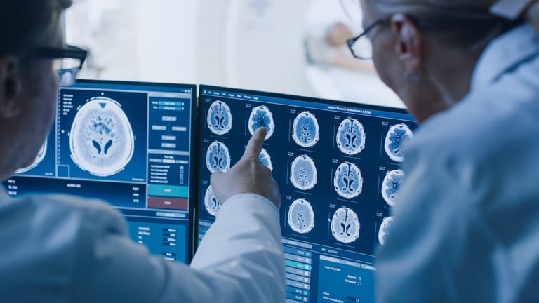 Gehirnscan (Symbolbild): Forschern ist es gelungen, mehr über die Ursachen einer Hirnvenenthrombose zu erfahren.