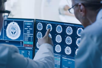 Gehirnscan (Symbolbild): Forschern ist es gelungen, mehr über die Ursachen einer Hirnvenenthrombose zu erfahren.