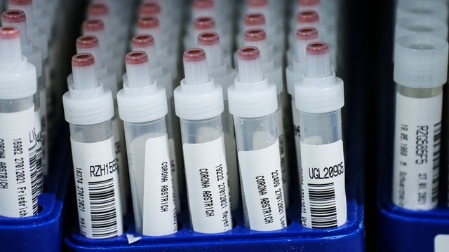 Die Zahl der Corona-Neuinfektionen geht zurück.