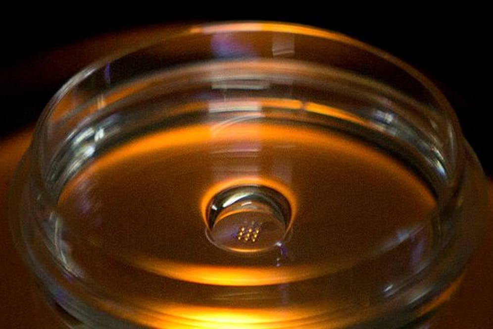 Eine Mikroplatte mit Embryonen, die mit Cas9-Protein und PCSK9 sgRNA injiziert wurden, ist in einem Labor in Shenzhen in der südchinesischen Provinz Guangdong zu sehen.