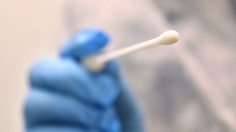 Ein Arzt hält einen Tupfer, mit dem ein Abstrich für einen Corona-Test gemacht wird (Symbolbild): Die sogenannten Impfdurchbrüche sollen weiter untersucht werden.
