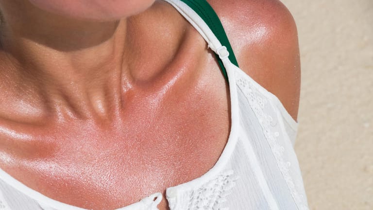 Eine Frau sonnt sich: UV-Strahlen lassen unsere Haut nicht nur schneller altern, sie erhöhen auch das Risiko für Hautkrebs.