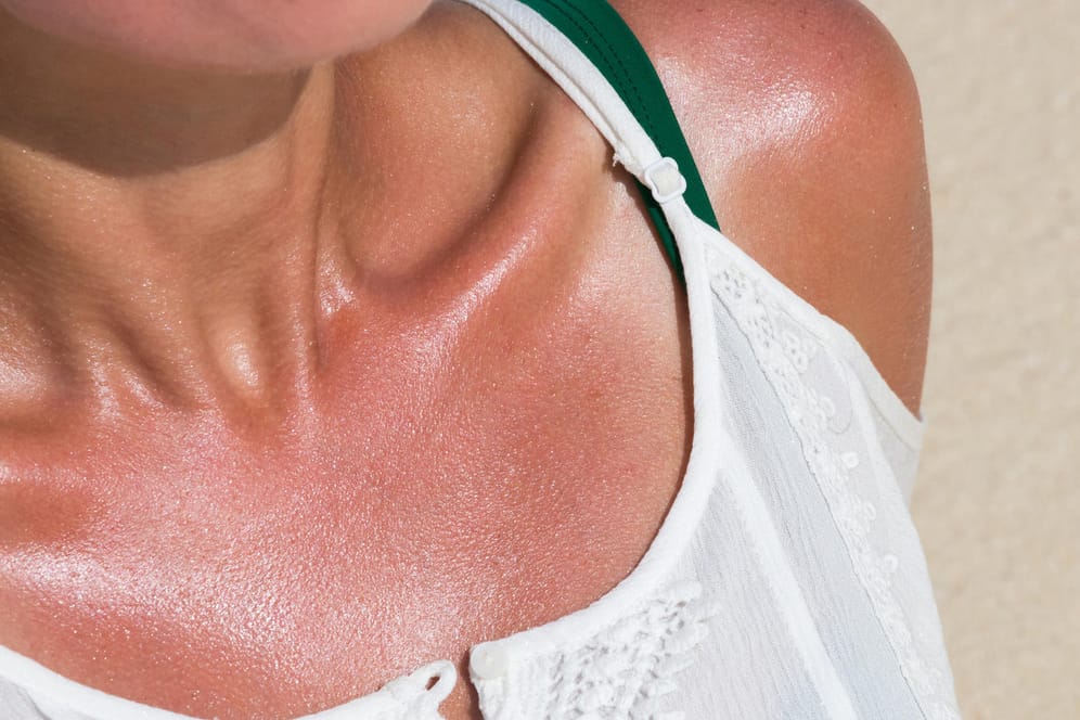 Eine Frau sonnt sich: UV-Strahlen lassen unsere Haut nicht nur schneller altern, sie erhöhen auch das Risiko für Hautkrebs.