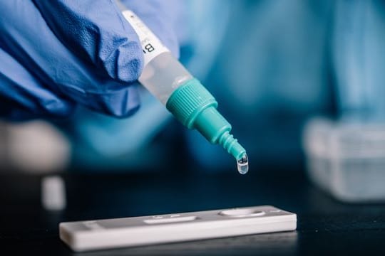 Ein Corona-Schnelltest: Für den Test braucht es Biomasse aus der Nase oder dem Rachen – aber keine Personalausweisnummer.