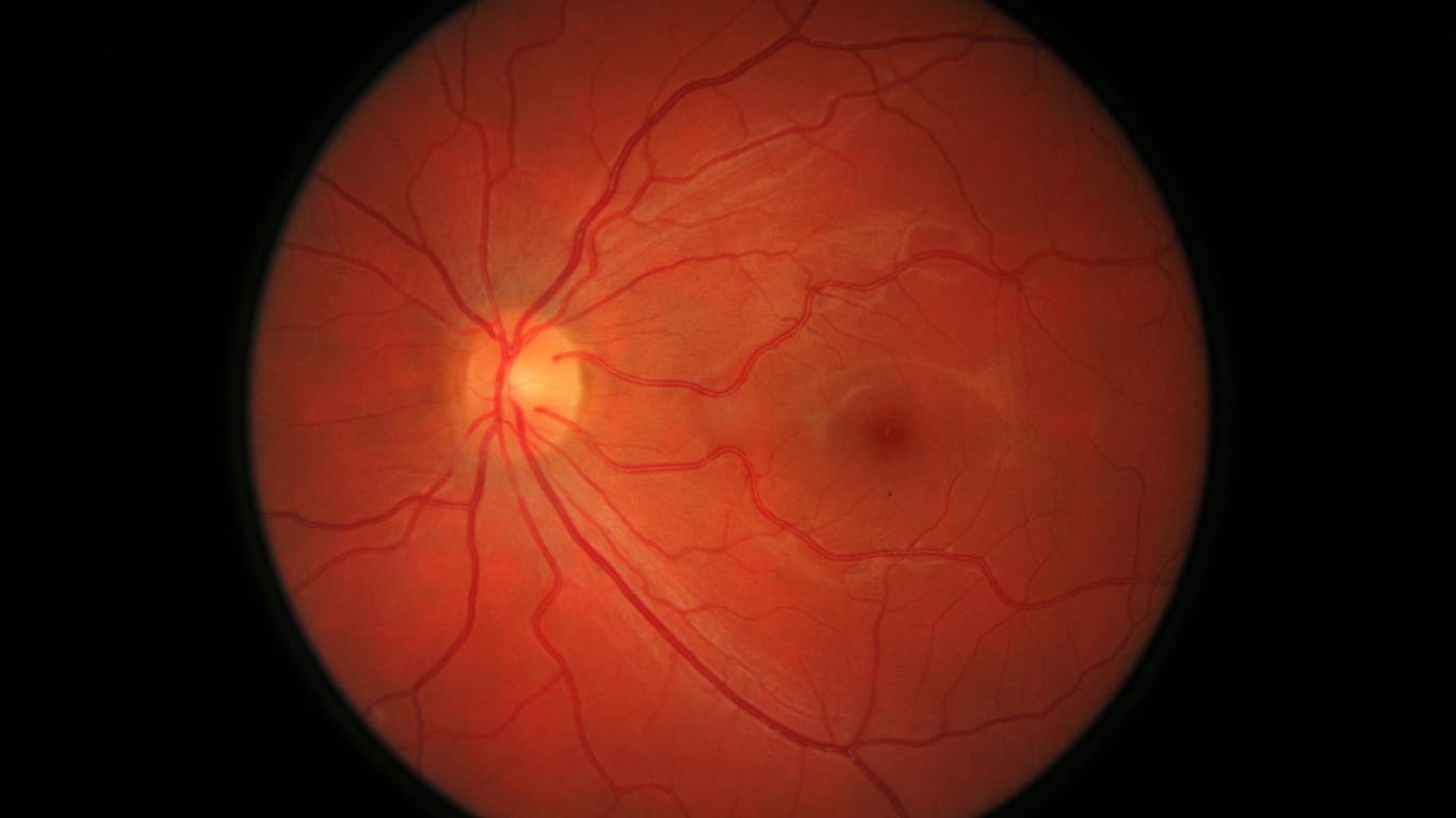 Aufnahme eines gesunden Auges: Die Makula befindet sich im Bereich des dunklen Flecks etwas rechts neben der Bildmitte.
