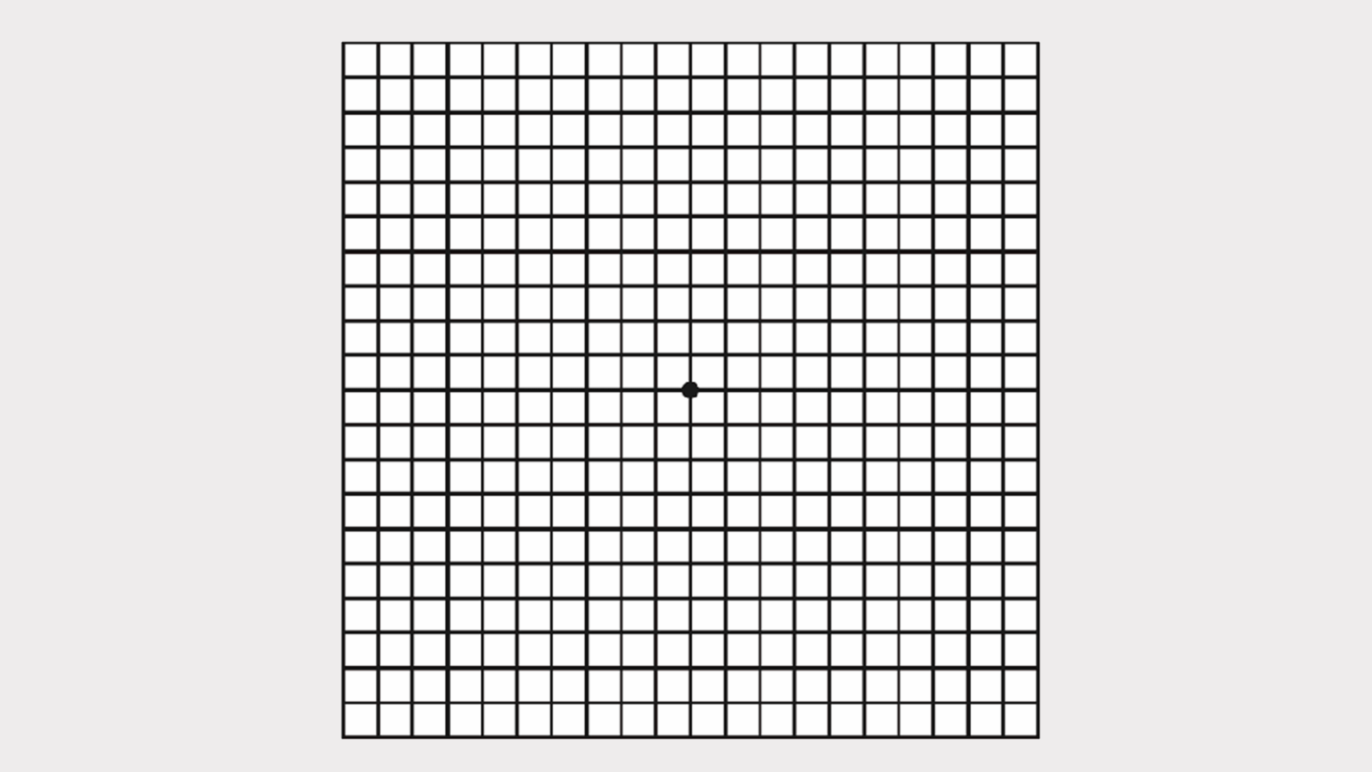 Amsler-Gitter-Test: Erscheinen beim Fixieren des Punkts einzelne Linien verzerrt oder gewellt, kann das auf eine Makuladegeneration hinweisen.