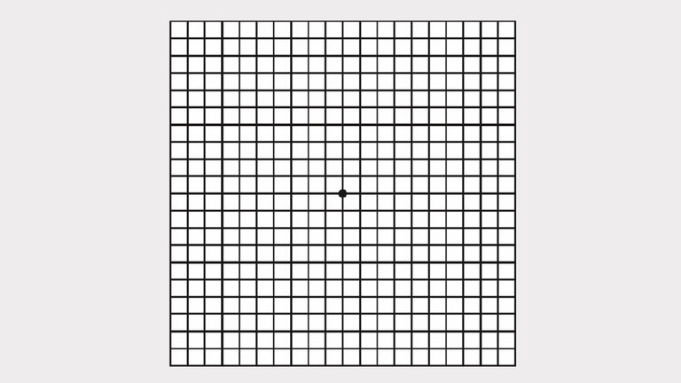 Amsler-Gitter-Test: Erscheinen beim Fixieren des Punkts einzelne Linien verzerrt oder gewellt, kann das auf eine Makuladegeneration hinweisen.