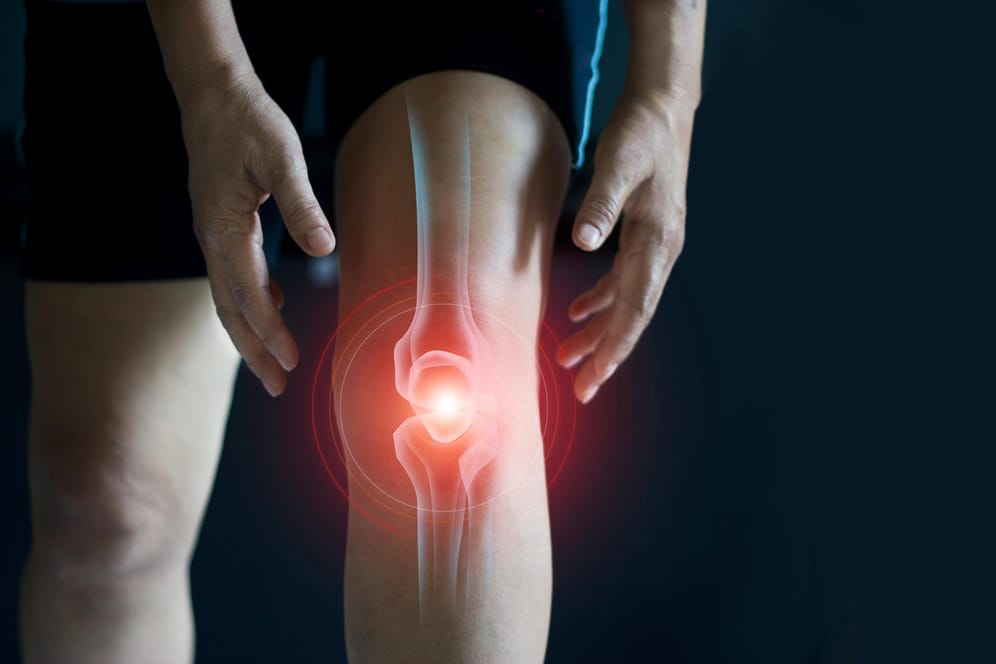 Ein Mann in Sporthose greift nach seinem Knie. Wer unter einer Kniearthrose leidet, sollte auf gelenkschonende Sportarten ausweichen.