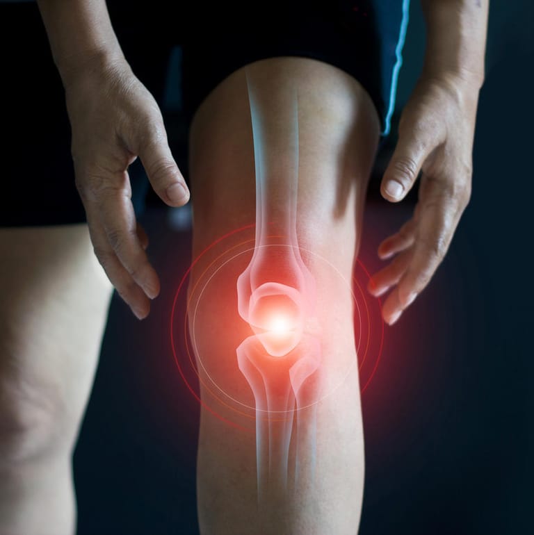 Ein Mann in Sporthose greift nach seinem Knie. Wer unter einer Kniearthrose leidet, sollte auf gelenkschonende Sportarten ausweichen.