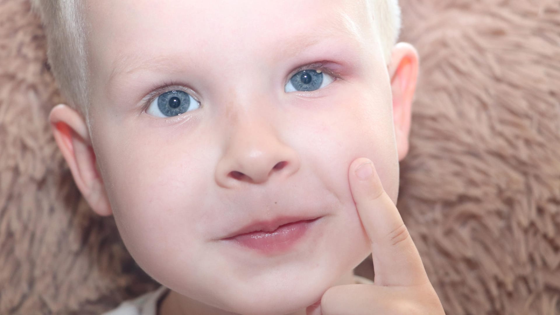 Gerstenkorn: Auch Kinder können daran erkranken.