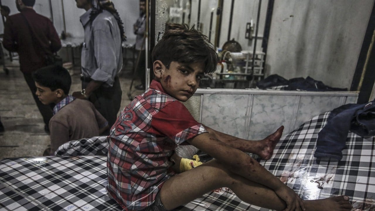 Nach einem Luftangriff sitzt ein verletzter Junge in einem Krankenhaus im syrischen Douma.