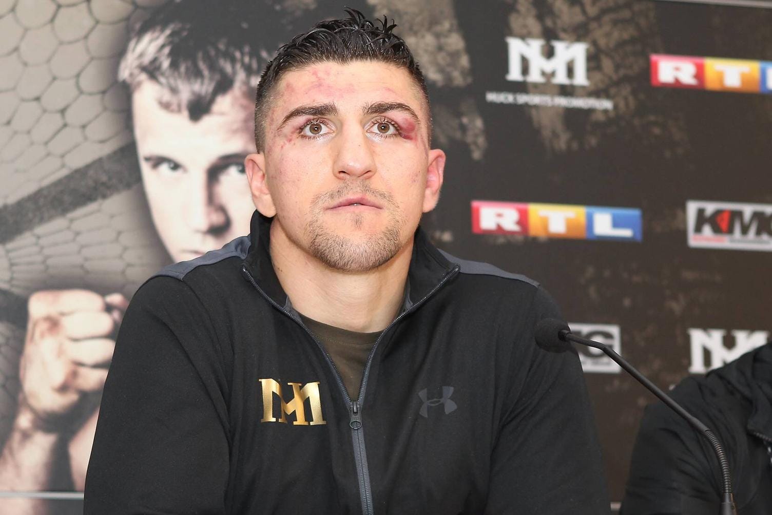 Marco Huck sind die Spuren des Kampfes deutlich anzusehen.