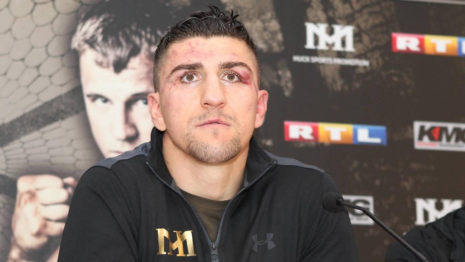 Marco Huck sind die Spuren des Kampfes deutlich anzusehen.