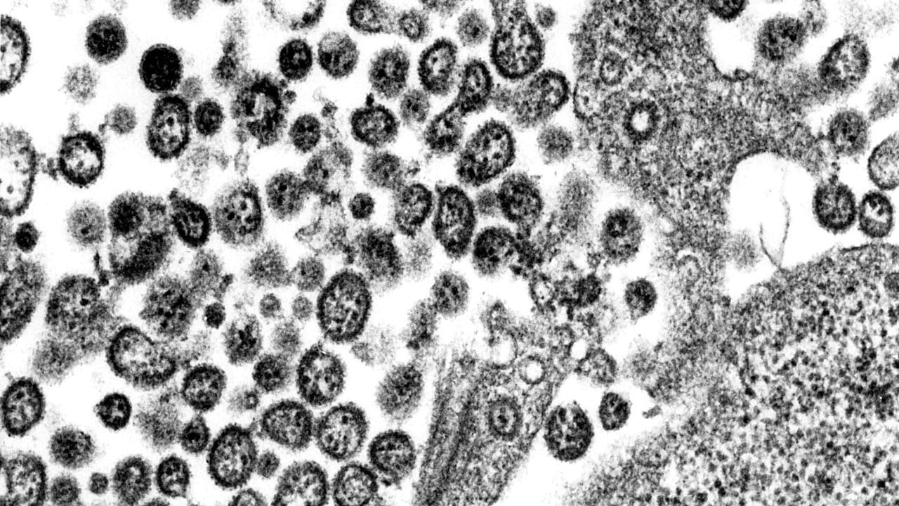 Lassa-Virus unter dem Elektronenmikroskop: In der globalisierten Welt von heute können sich Seuchen immer schneller verbreiten. Lassa-Virus unter dem Elektronenmikroskop: In der globalisierten Welt von heute können sich Seuchen immer schneller verbreiten.