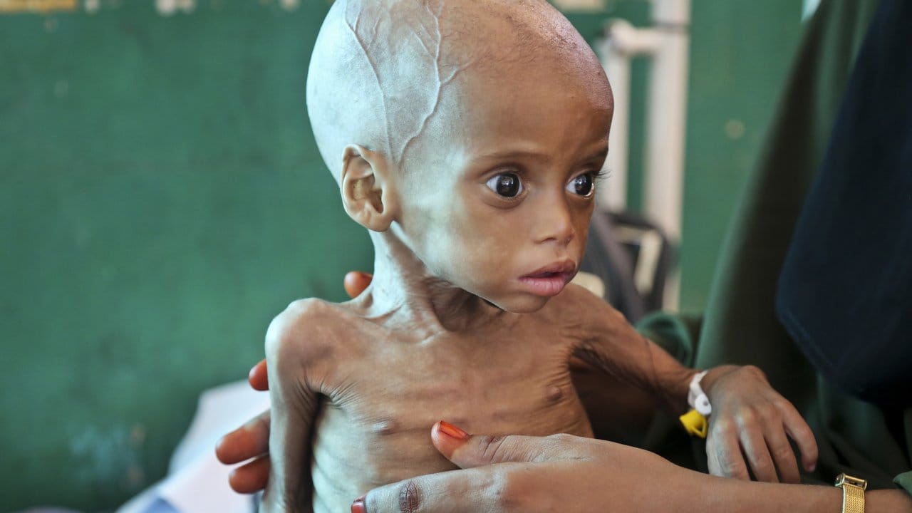 Hungersnot in Somalia: Das alle vier Jahre auftretende Wetterphänomen El Niño vernichtet Ernten die Ernten in Ostafrika. Hungersnot in Somalia: Das alle vier Jahre auftretende Wetterphänomen El Niño vernichtet Ernten die Ernten in Ostafrika.
