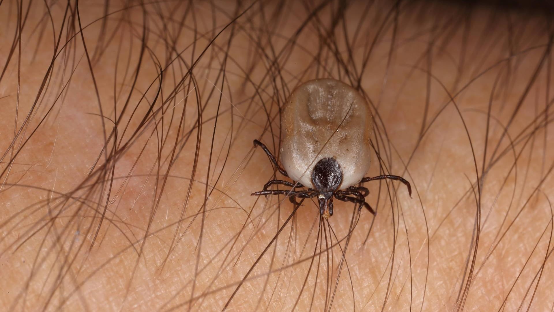 Zecke auf der Haut: Ein Protein hilft Zecken dabei, auf ihren Wirten haften zu bleiben.