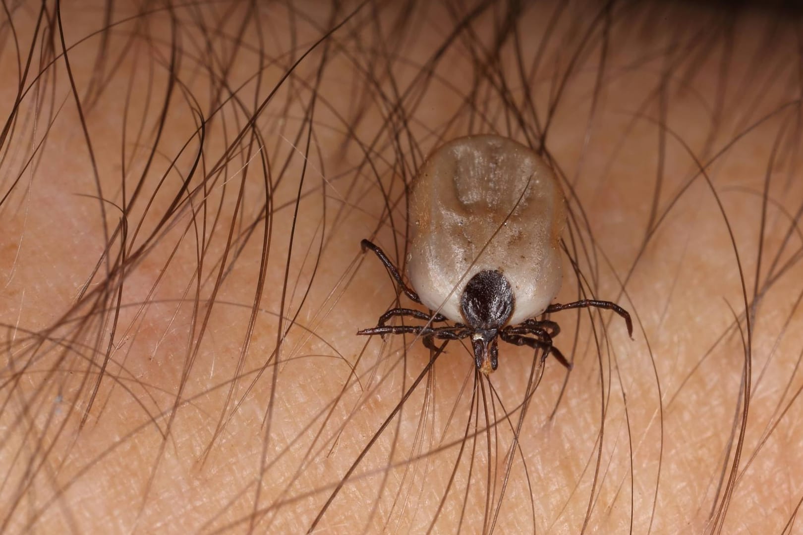 Zecke auf der Haut: Ein Protein hilft Zecken dabei, auf ihren Wirten haften zu bleiben.