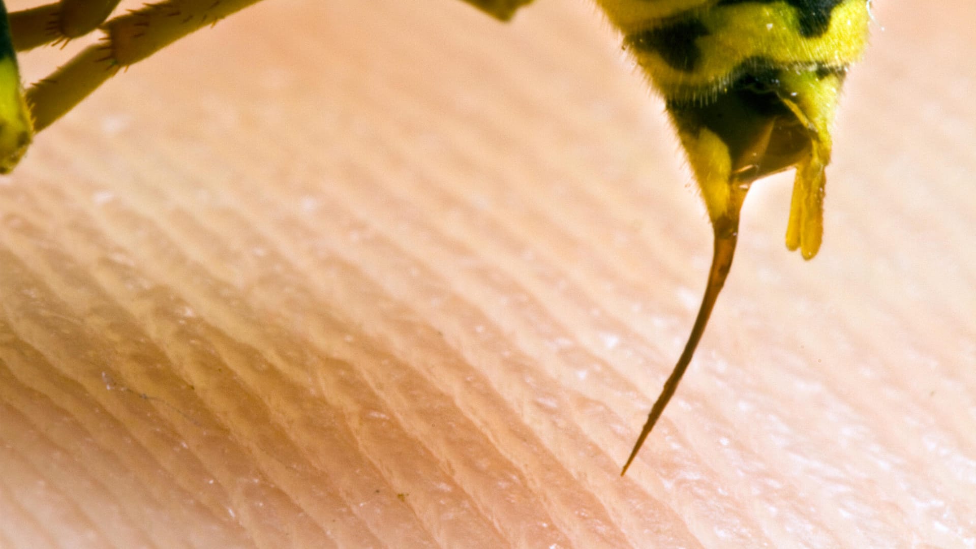 Wespenstachel: Anders als Bienen, können Wespen und Hornissen mehrfach stechen.