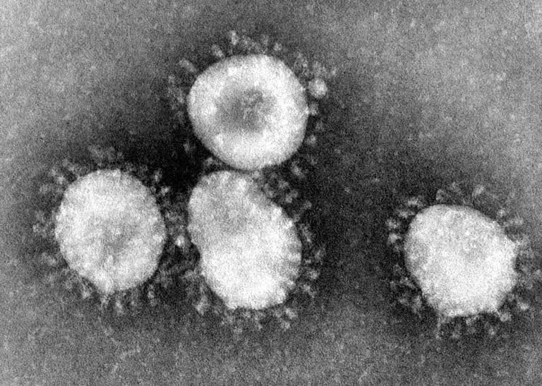 MERS-Coronavirus: MERS steht für das 2012 erstmals identifizierte Middle East Respiratory Syndrome und bezeichnet eine schwere bis tödliche Infektion der Atemwege.