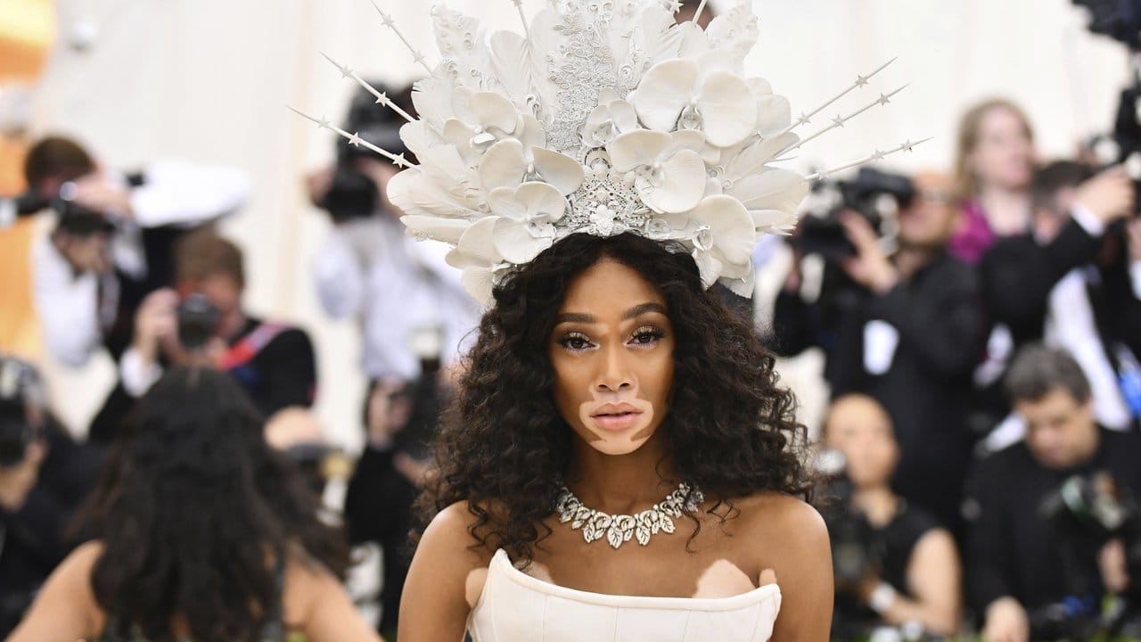 Model Winnie Harlow bei der "Met Gala" 2018. Model Winnie Harlow bei der "Met Gala" 2018.