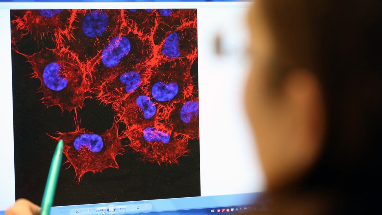 Blick auf Melanom-Zellen im Labor des Instituts für Experimentelle Gentherapie und Tumorforschung der Universitätsmedizin Rostock.