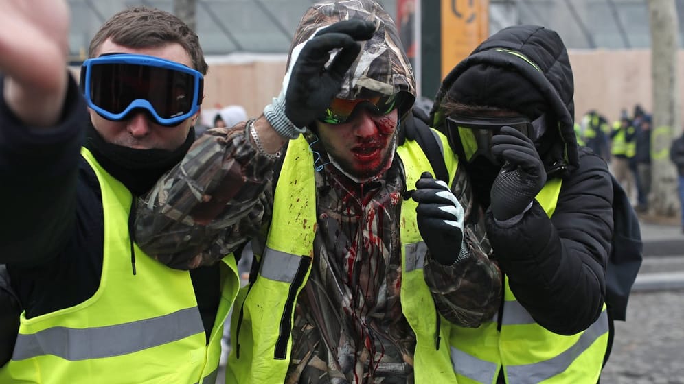 Mit Blut bedeckt: Ein Demonstrant der Gelbwesten wurde bei den Protesten verletzt.